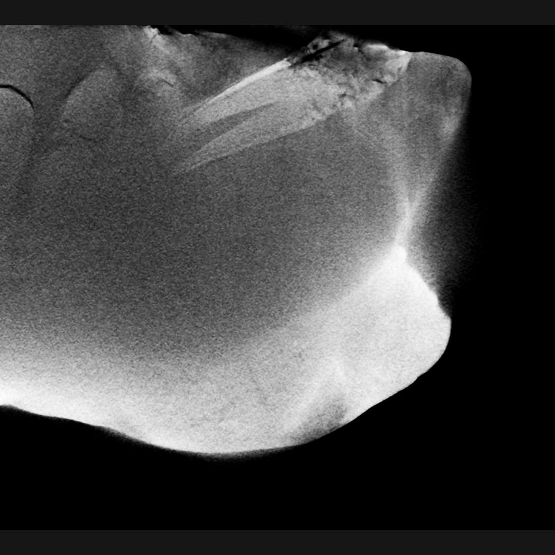 Here are some frames I took from a video of the scan of some cetacean teeth I found in a concretion. It was scanned by a beam of neutrons at ANSTO as traditional x-rays aren't powerful enough to penetrate this dense rock from what I understand.

Keep an eye on my YouTube channel for the full video, it's pretty mind-blowing footage! 

This is going to help me prep the concretion as I now have a map of where the teeth and bones are in the rock.

      